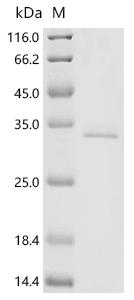 (Tris-Glycine gel) Discontinuous SDS-PAGE (reduced) with 5% enrichment gel and 15% separation gel.