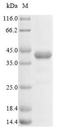 (Tris-Glycine gel) Discontinuous SDS-PAGE (reduced) with 5% enrichment gel and 15% separation gel.