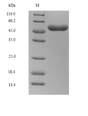 (Tris-Glycine gel) Discontinuous SDS-PAGE (reduced) with 5% enrichment gel and 15% separation gel.