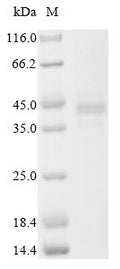 (Tris-Glycine gel) Discontinuous SDS-PAGE (reduced) with 5% enrichment gel and 15% separation gel.