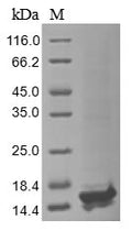 (Tris-Glycine gel) Discontinuous SDS-PAGE (reduced) with 5% enrichment gel and 15% separation gel.