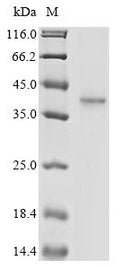 (Tris-Glycine gel) Discontinuous SDS-PAGE (reduced) with 5% enrichment gel and 15% separation gel.