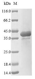 (Tris-Glycine gel) Discontinuous SDS-PAGE (reduced) with 5% enrichment gel and 15% separation gel.