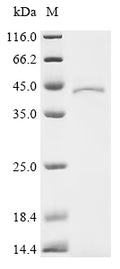 (Tris-Glycine gel) Discontinuous SDS-PAGE (reduced) with 5% enrichment gel and 15% separation gel.