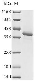 (Tris-Glycine gel) Discontinuous SDS-PAGE (reduced) with 5% enrichment gel and 15% separation gel.