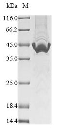 (Tris-Glycine gel) Discontinuous SDS-PAGE (reduced) with 5% enrichment gel and 15% separation gel.