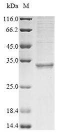 (Tris-Glycine gel) Discontinuous SDS-PAGE (reduced) with 5% enrichment gel and 15% separation gel.