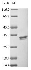 (Tris-Glycine gel) Discontinuous SDS-PAGE (reduced) with 5% enrichment gel and 15% separation gel.