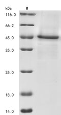 (Tris-Glycine gel) Discontinuous SDS-PAGE (reduced) with 5% enrichment gel and 15% separation gel.