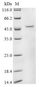 (Tris-Glycine gel) Discontinuous SDS-PAGE (reduced) with 5% enrichment gel and 15% separation gel.