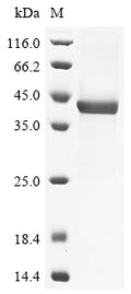 (Tris-Glycine gel) Discontinuous SDS-PAGE (reduced) with 5% enrichment gel and 15% separation gel.