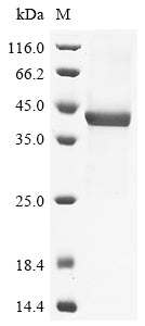 (Tris-Glycine gel) Discontinuous SDS-PAGE (reduced) with 5% enrichment gel and 15% separation gel.