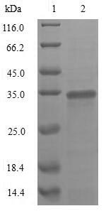 (Tris-Glycine gel) Discontinuous SDS-PAGE (reduced) with 5% enrichment gel and 15% separation gel.