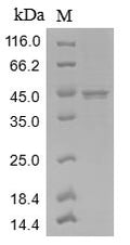 (Tris-Glycine gel) Discontinuous SDS-PAGE (reduced) with 5% enrichment gel and 15% separation gel.