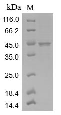 (Tris-Glycine gel) Discontinuous SDS-PAGE (reduced) with 5% enrichment gel and 15% separation gel.