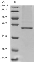 (Tris-Glycine gel) Discontinuous SDS-PAGE (reduced) with 5% enrichment gel and 15% separation gel.