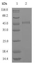 (Tris-Glycine gel) Discontinuous SDS-PAGE (reduced) with 5% enrichment gel and 15% separation gel.