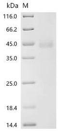 (Tris-Glycine gel) Discontinuous SDS-PAGE (reduced) with 5% enrichment gel and 15% separation gel.