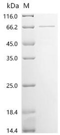 (Tris-Glycine gel) Discontinuous SDS-PAGE (reduced) with 5% enrichment gel and 15% separation gel.