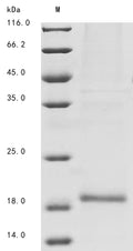 (Tris-Glycine gel) Discontinuous SDS-PAGE (reduced) with 5% enrichment gel and 15% separation gel.