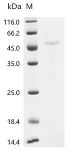 (Tris-Glycine gel) Discontinuous SDS-PAGE (reduced) with 5% enrichment gel and 15% separation gel.