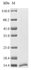 (Tris-Glycine gel) Discontinuous SDS-PAGE (reduced) with 5% enrichment gel and 15% separation gel.