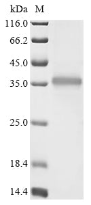 (Tris-Glycine gel) Discontinuous SDS-PAGE (reduced) with 5% enrichment gel and 15% separation gel.