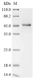 (Tris-Glycine gel) Discontinuous SDS-PAGE (reduced) with 5% enrichment gel and 15% separation gel.
