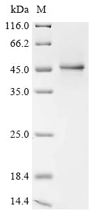 (Tris-Glycine gel) Discontinuous SDS-PAGE (reduced) with 5% enrichment gel and 15% separation gel.