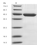 (Tris-Glycine gel) Discontinuous SDS-PAGE (reduced) with 5% enrichment gel and 15% separation gel.