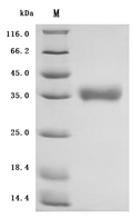 (Tris-Glycine gel) Discontinuous SDS-PAGE (reduced) with 5% enrichment gel and 15% separation gel.