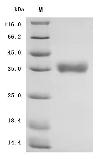 (Tris-Glycine gel) Discontinuous SDS-PAGE (reduced) with 5% enrichment gel and 15% separation gel.