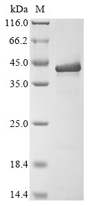 (Tris-Glycine gel) Discontinuous SDS-PAGE (reduced) with 5% enrichment gel and 15% separation gel.