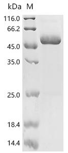 (Tris-Glycine gel) Discontinuous SDS-PAGE (reduced) with 5% enrichment gel and 15% separation gel.