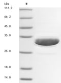 (Tris-Glycine gel) Discontinuous SDS-PAGE (reduced) with 5% enrichment gel and 15% separation gel.