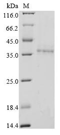 (Tris-Glycine gel) Discontinuous SDS-PAGE (reduced) with 5% enrichment gel and 15% separation gel.