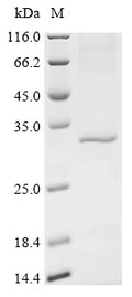 (Tris-Glycine gel) Discontinuous SDS-PAGE (reduced) with 5% enrichment gel and 15% separation gel.