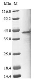 (Tris-Glycine gel) Discontinuous SDS-PAGE (reduced) with 5% enrichment gel and 15% separation gel.