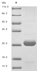 (Tris-Glycine gel) Discontinuous SDS-PAGE (reduced) with 5% enrichment gel and 15% separation gel.