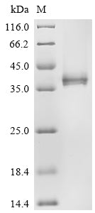 Recombinant Human Interleukin-12 receptor subunit beta-2 (IL12RB2), partial – Figure 1 of 1