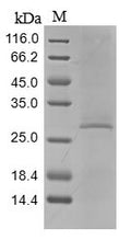 (Tris-Glycine gel) Discontinuous SDS-PAGE (reduced) with 5% enrichment gel and 15% separation gel.