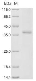 (Tris-Glycine gel) Discontinuous SDS-PAGE (reduced) with 5% enrichment gel and 15% separation gel.