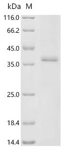 (Tris-Glycine gel) Discontinuous SDS-PAGE (reduced) with 5% enrichment gel and 15% separation gel.