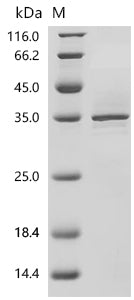 (Tris-Glycine gel) Discontinuous SDS-PAGE (reduced) with 5% enrichment gel and 15% separation gel.