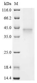 (Tris-Glycine gel) Discontinuous SDS-PAGE (reduced) with 5% enrichment gel and 15% separation gel.