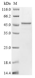 (Tris-Glycine gel) Discontinuous SDS-PAGE (reduced) with 5% enrichment gel and 15% separation gel.