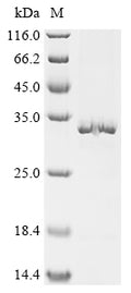(Tris-Glycine gel) Discontinuous SDS-PAGE (reduced) with 5% enrichment gel and 15% separation gel.