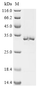 (Tris-Glycine gel) Discontinuous SDS-PAGE (reduced) with 5% enrichment gel and 15% separation gel.