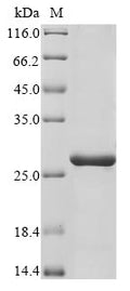 (Tris-Glycine gel) Discontinuous SDS-PAGE (reduced) with 5% enrichment gel and 15% separation gel.