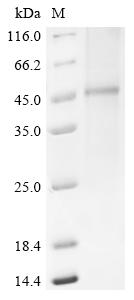 (Tris-Glycine gel) Discontinuous SDS-PAGE (reduced) with 5% enrichment gel and 15% separation gel.